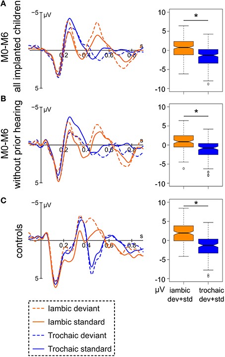Left: Event-related potentials for (A) implanted children (N=47) and (B) a subgroup of CI children who were congenitally deaf (N=19) and (C) a control group (N=24) at electrode Fz. Right: Respective boxplot representation of the amplitude difference between the iambic and the trochaic stimuli averaged over deviant and standard in the range of 444-544 ms (implanted children) and 404-504 ms (controls).