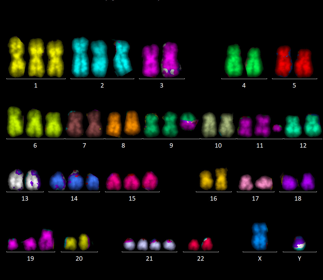 komplex-aberrante-metaphase.jpg